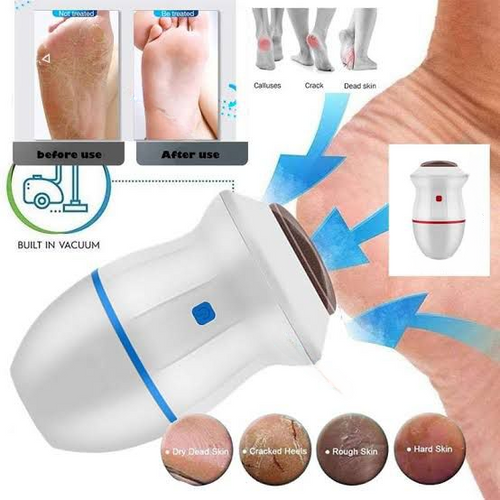 Dead Skin Remover for Smooth Feet